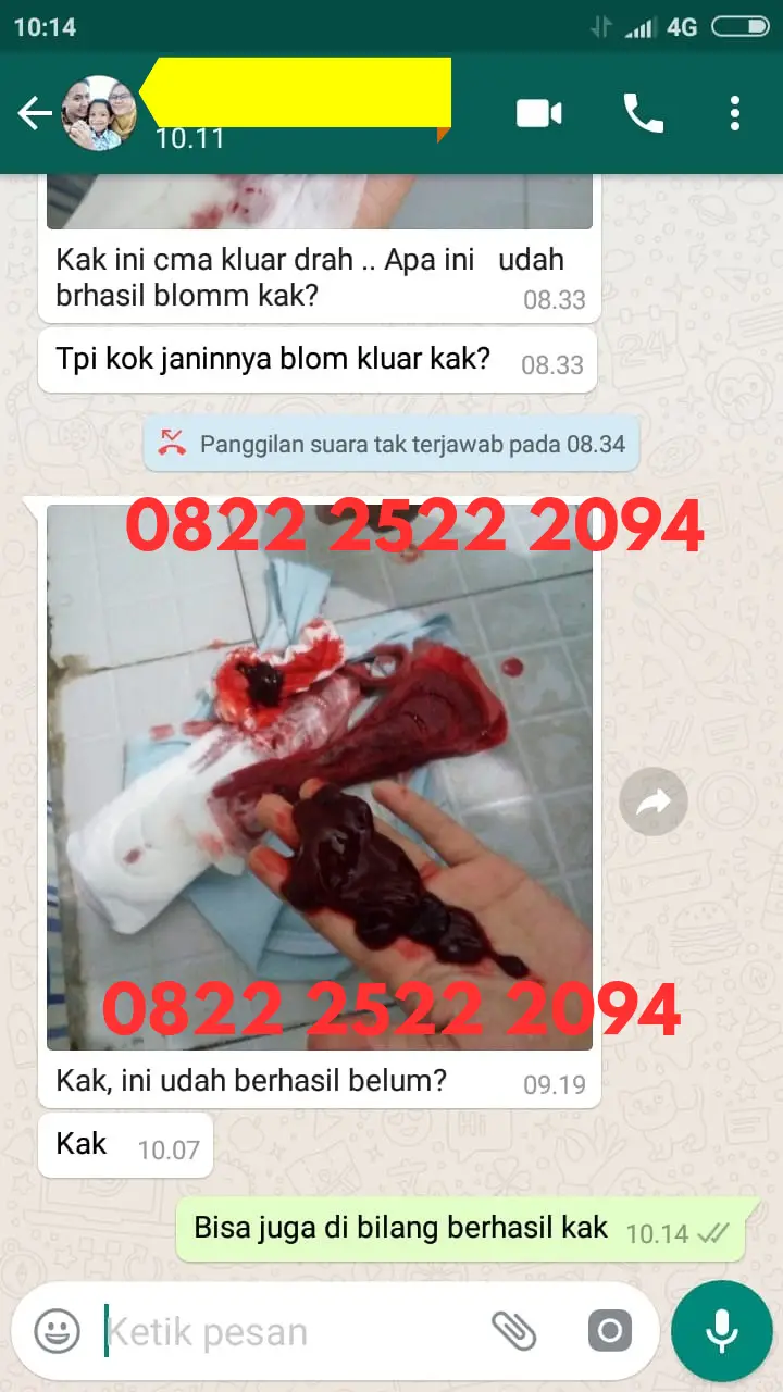 Obat Telat Datang Bulan Paling Manjur Di Apotik Dan Harganya