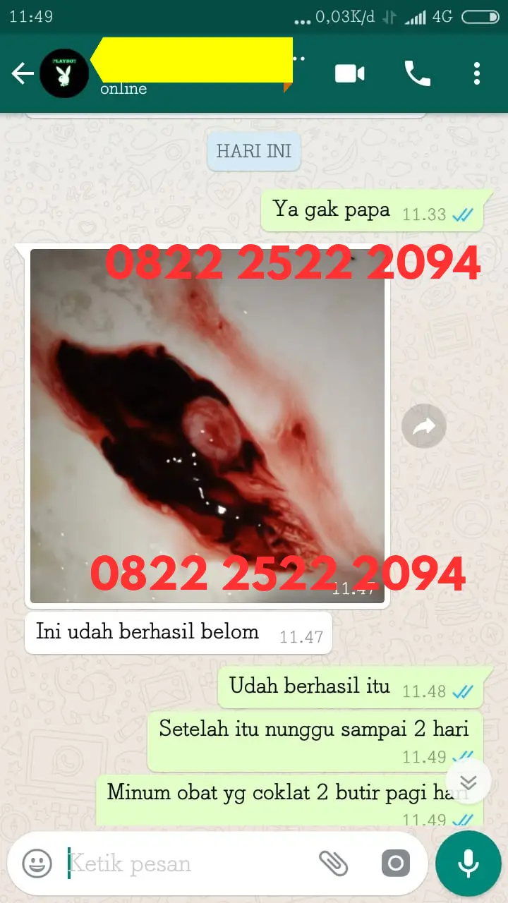 Obat Telat Datang Bulan Paling Manjur Di Apotik Dan Harganya